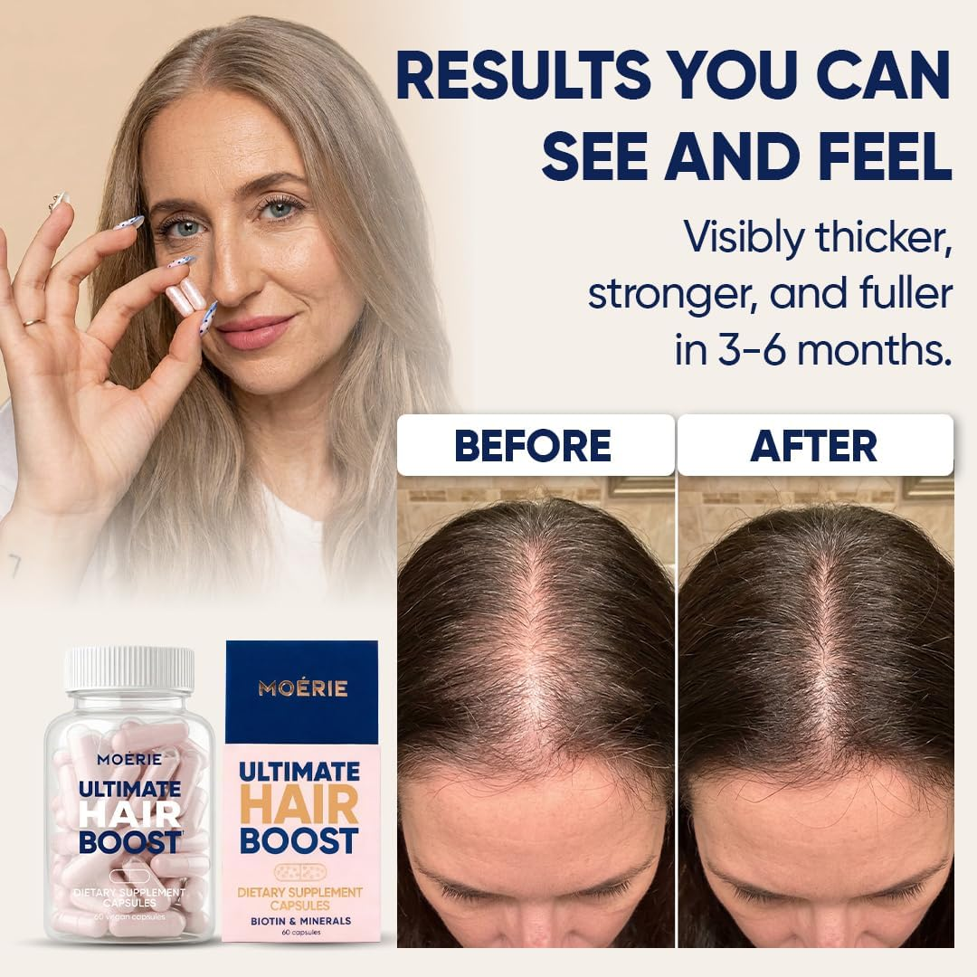 Ultimate Hair Boost Supplement 60 capsules