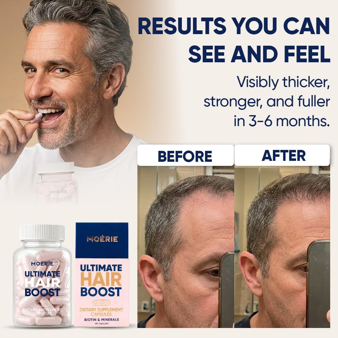 Ultimate Hair Boost Supplement 60 capsules